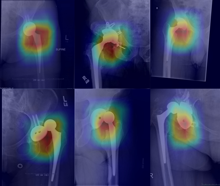 Dislocation Detection